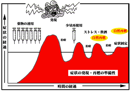 薬物のフラッシュバック